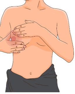 reducción mamaria