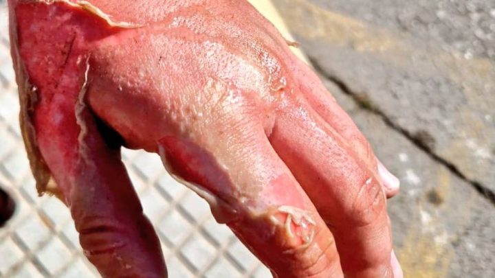 Incendio de una sartén con aceite en Tomares: Importancia de actuar correctamente ante un fuego en la cocina